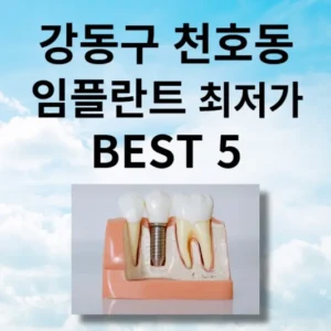 서울시 강동구 천호동 임플란트 비용 가격 및 BEST 5