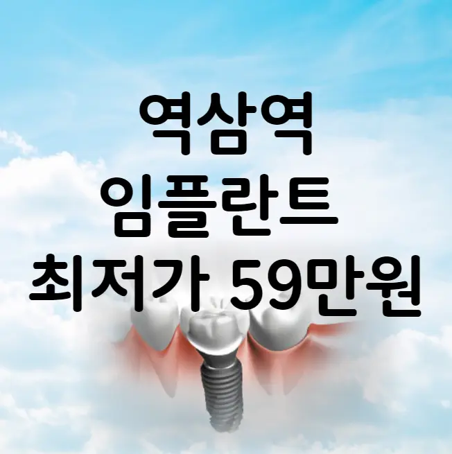 역삼역 임플란트 가격 비용