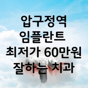 압구정역 임플란트 가격 비용