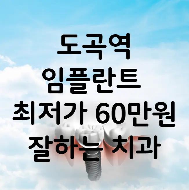 도곡역 임플란트 가격 비용