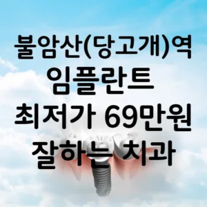 불암산역(당고개역) 임플란트 가격 비용