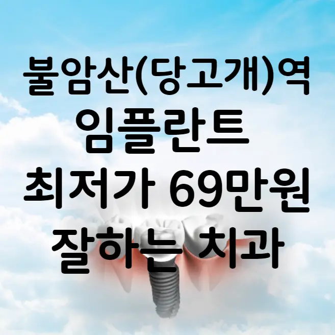 불암산역(당고개역) 임플란트 가격 비용