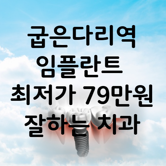 굽은다리역 임플란트 가격 비용